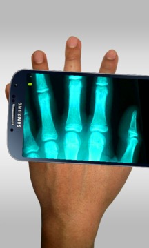 x光扫描仪 Xray scanner5