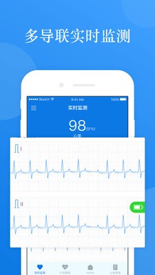 AI ECG1