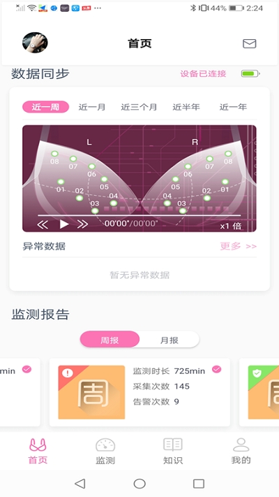 乳腺健康监测1