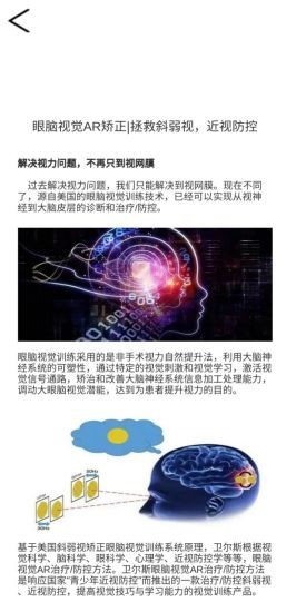 卫尔斯眼视觉3