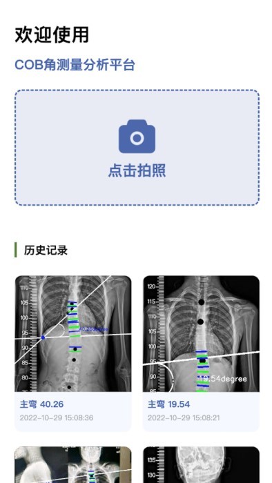 cobb角测量分析平台2