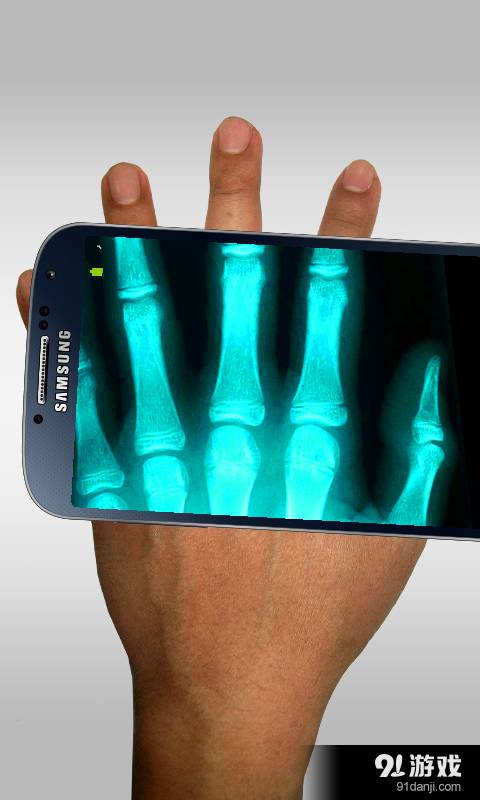 Xray Scanner5