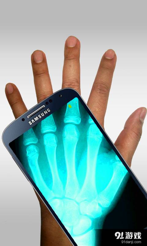 Xray Scanner6