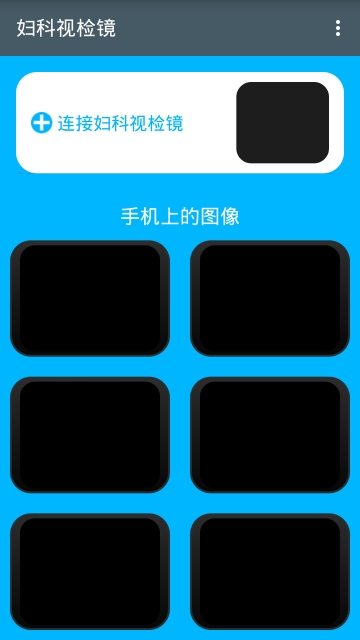 妇科视检镜1