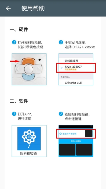 妇科视检镜2