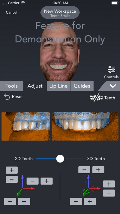 Bellus3D4