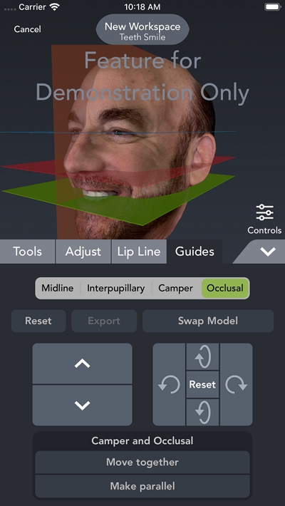 Bellus3D6