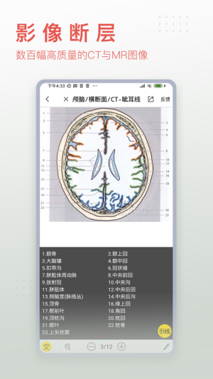 3Dbody解剖4