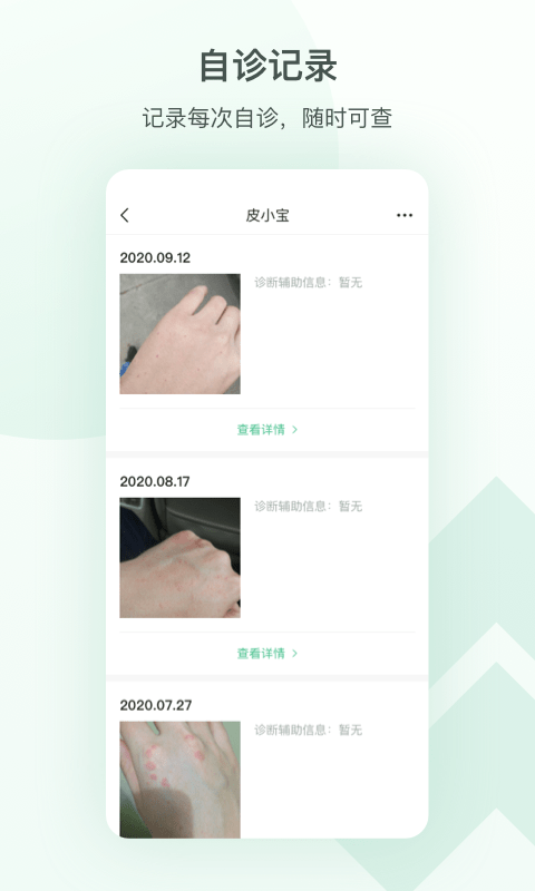 皮小宝3